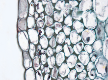 Cross section of collenchyma cells Plant cell type collenchyma.png