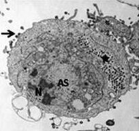 FV3-infizierte Zelle mit Kern (N), Chromatin­kondensation, viraler Assemblierungs­stelle (AS), para­kristallinen Anordnungen (*) und knospenden Virionen (→).