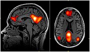 Miniatura para Red neuronal por defecto