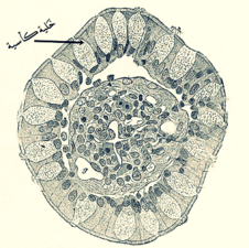 صُورة للخملة المعوية حيثُ تظهر بِها الخَلية الكَأسية.