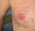 Nipple piercing with barbell on a man