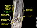 Múscul extensor radial llarg del carp.