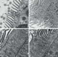 Electron microscopy of Cepedea longa