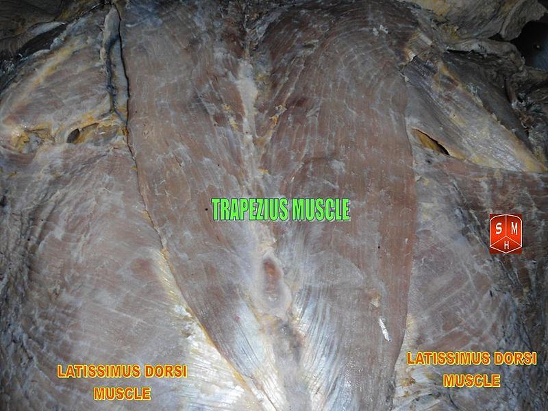 File:Trapezius muscle.JPG