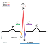 Schematic representation of normal ECG trace showing sinus rhythm, an example of a biomedical engineering application of electronic engineering to electrophysiology and medical diagnosis.