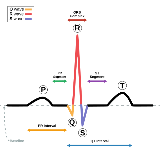 File:SinusRhythmLabels.svg