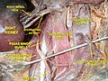 Inferior vena cava vedere frontală