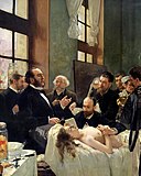 "Avant l'Opération"(1887)