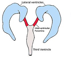 Interventricularforamina.jpg