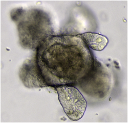 Střevní organoid. PNG