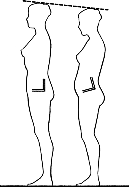 pelvic tilt