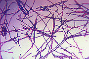 Foto mikrograf B. anthracis dengan pewarnaan Gram