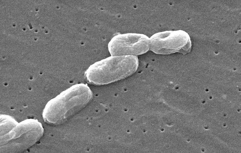 File:Burkholderia cepacia.jpg