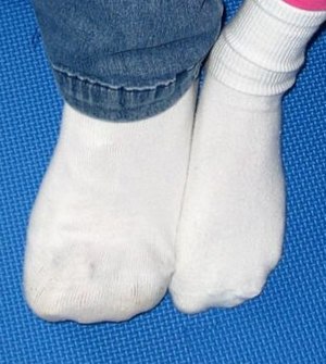 Feet in white socks compared