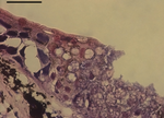 Miniatura para Batrachochytrium salamandrivorans