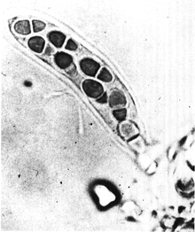 Ascospores of Didymella Rabiei Bitunicate ascus and ascospores of Didymella rabiei.png