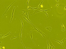 Human bone marrow derived mesenchymal stem cells seen under phase contrast microscope at 63-times magnification) Human bone marrow derived MSCs.jpg