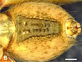 Opisthosoma (Hinterleib) eines präparierten Männchens ventral mit gut erkennbaren Spinnwarzen im Detail