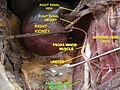 Musculus psoas major