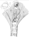Depiction of the origin of the suspensory muscle, from the fibres of the right diaphragmatic crus（英语：diaphragmatic crura）