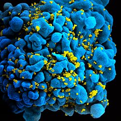 صُورة مجهريَّة لخليَّة تائيَّة مُصابة بڤيروس العوز المناعي البشري (الأيدز أو السيدا)