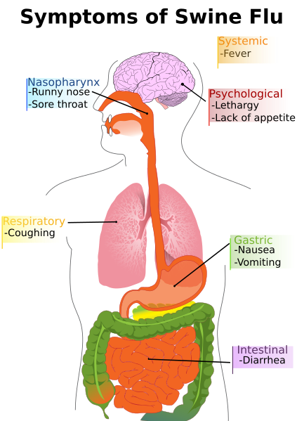 swine flu symptoms elderly