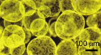 Colonies of the alga Phaeocystis antarctica, an important phytoplankter of the Ross Sea that dominates early season blooms after the sea ice retreats and exports significant carbon.[129]