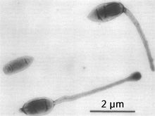 Three representative cell types of a culture of "Hyphomicrobium" sp.. Note short processes on two of the three cells, thought to be remnants of the former mother hypha