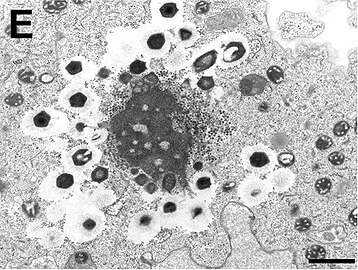 Electron micrograph of virus factory in an amoeba co-infected with Zamilon and Mont1 (scale bar: 0.1 μm)