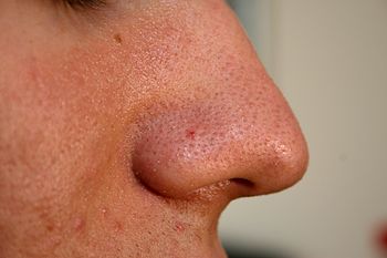English: Nose from a 20 years old male human. ...