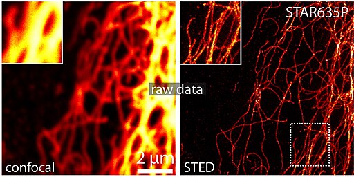 STED microscopy image of Vimentin with 25nm resolution