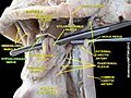 Hypoglossal nerve