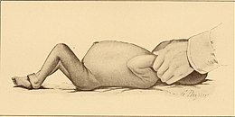 Description de l'image The diseases of infancy and childhood (1910) (14761683704).jpg.