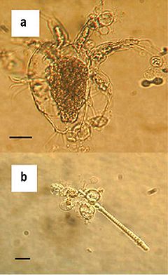 Зооспорангія Batrachochytrium dendrobatidis, що росте на прісноводних членистоногих (a) та водоростях (b). машатабна лінія показує 30 µm.