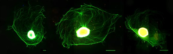 Ганглії. Спінальні нервові вузли, або ганглії (центральна бульба з ~10 000 нейронами), з радіально виходячими з них аксонами, екстраговані зі спинного мозку новонароджених щурів (2-3 дні); пройшли імунофарбування, сфотографовані за допомогою методу флуоресцентної мікроскопії. Автор: Kseniia Bondarenko