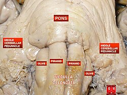 Medulla oblongata, pons and middle cerebellar peduncle.jpg