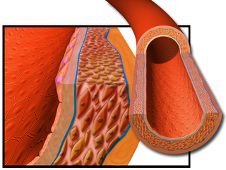 Artery.