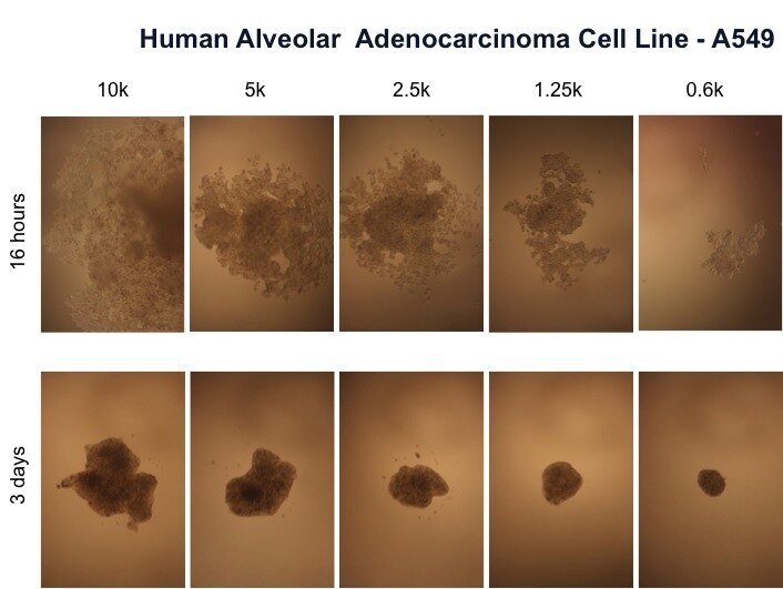 File:Human alveolar adenocarcinoma cell line - A549 cultured by MLM at different time points and cell numbers.tiff