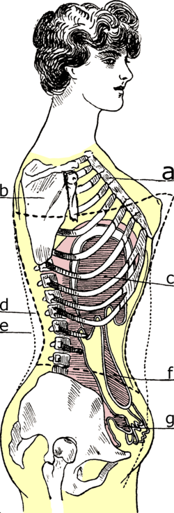 Fig. 135. — Comment le corset cambré déforme le corps.