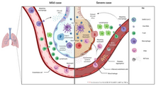 Mild versus severe immune response during virus infection Ijms-21-05932-g004.webp