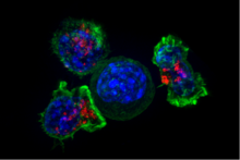 Superresolution image of a group of cytotoxic T cells surrounding a cancer cell Killer T cells surround a cancer cell.png