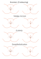 Vorschaubild der Version vom 00:51, 5. Dez. 2010