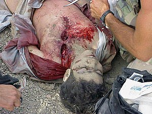 Omar Khadr getting battlefield first aid.