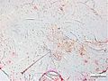 Ferrisia virgata gonopore