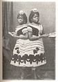 Millie og Christine McCoy (1851–1912), sammenvokste tvillinger fra USA. Foto: England, ca. 1873