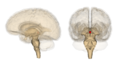 בתמונה זה רואים את גזע המוח ואת תחילת עמוד השדרה