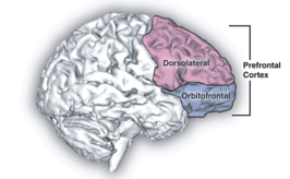 Frontaal syndroom