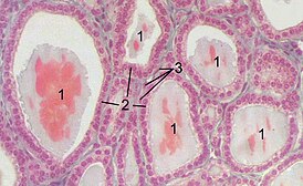 Микропрепарат щитовидной железы: 1 — фолликулы, содержащие коллоид; 2 — фолликулярный эпителий; 3 — капилляры.