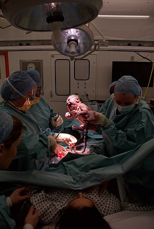 London, England Caesearian Surgery, obstetrici...
