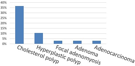 Gallbladder polyp types by relative incidence.[5]